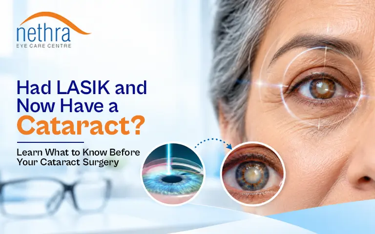 cataract-surgery-after-lasik-thrissur